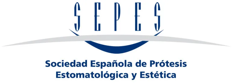 Sepes